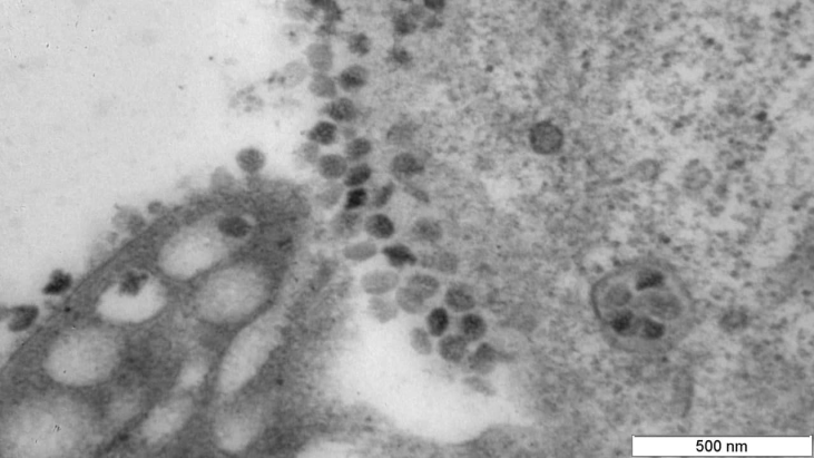 "Nos próximos dias vamos atingir o pico da variante Ômicron", diz infectologista